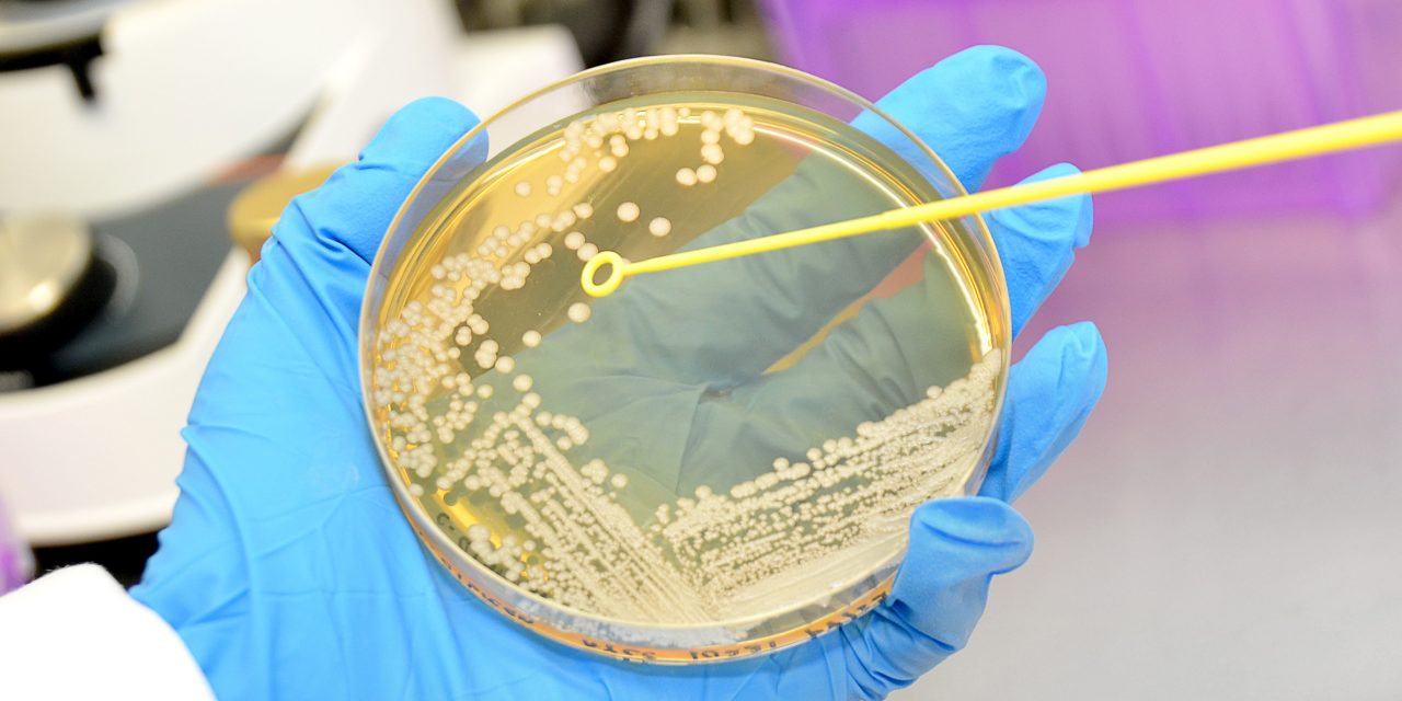 Candida auris Outbreak in the United States