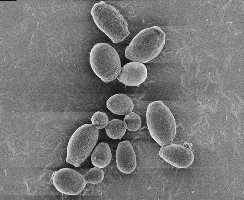 Candida auris Outbreak in the United States TECOLAB