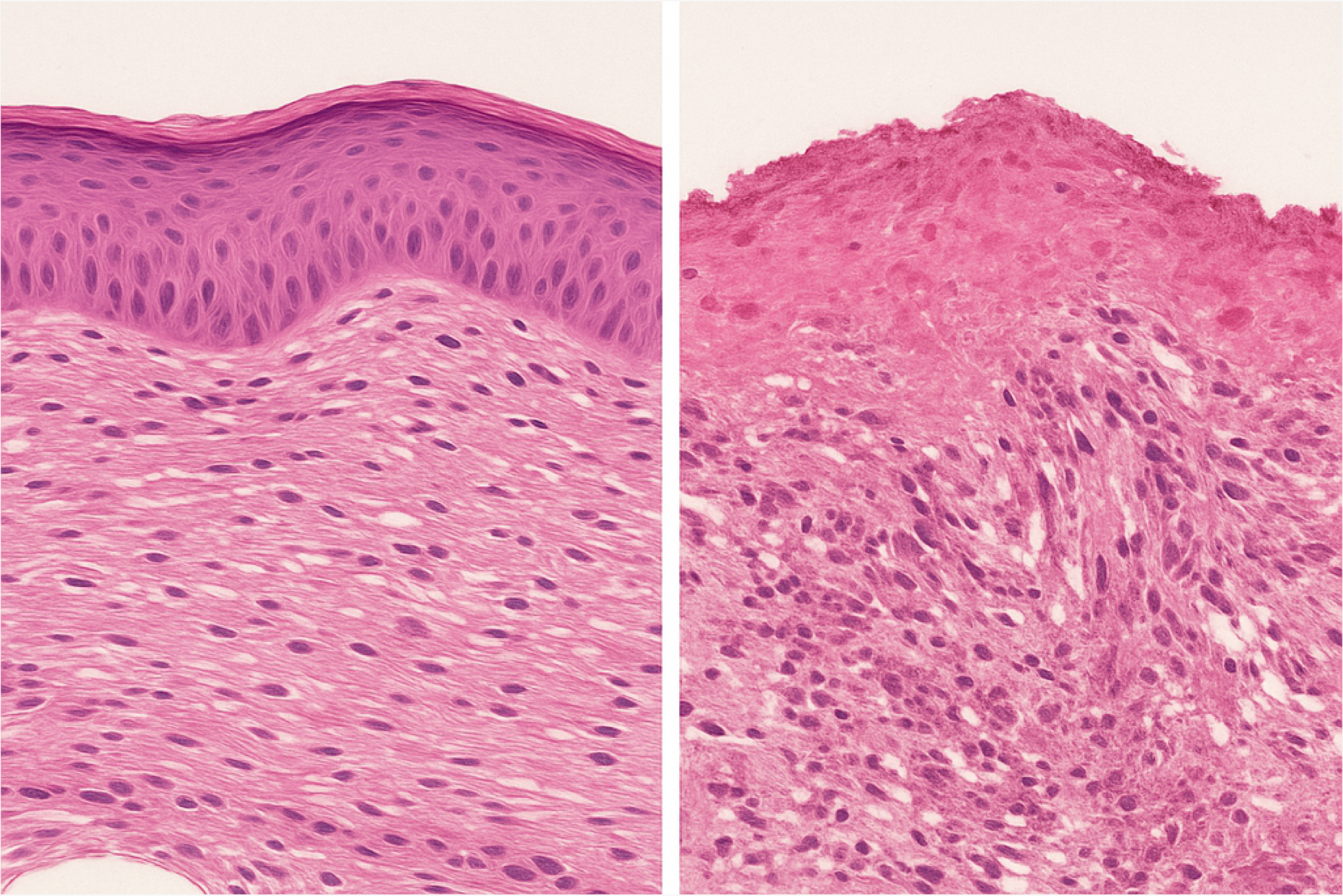 Skin Corrosion Test