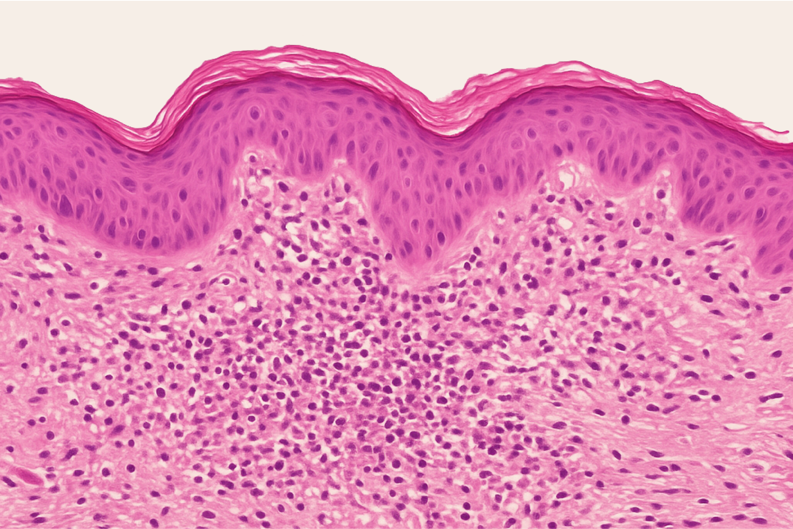Skin Irritation Test